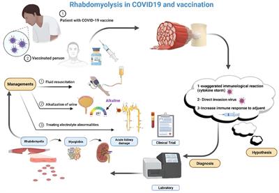 Rhabdomyolysis secondary to COVID-19 infection and vaccination: a review of literature